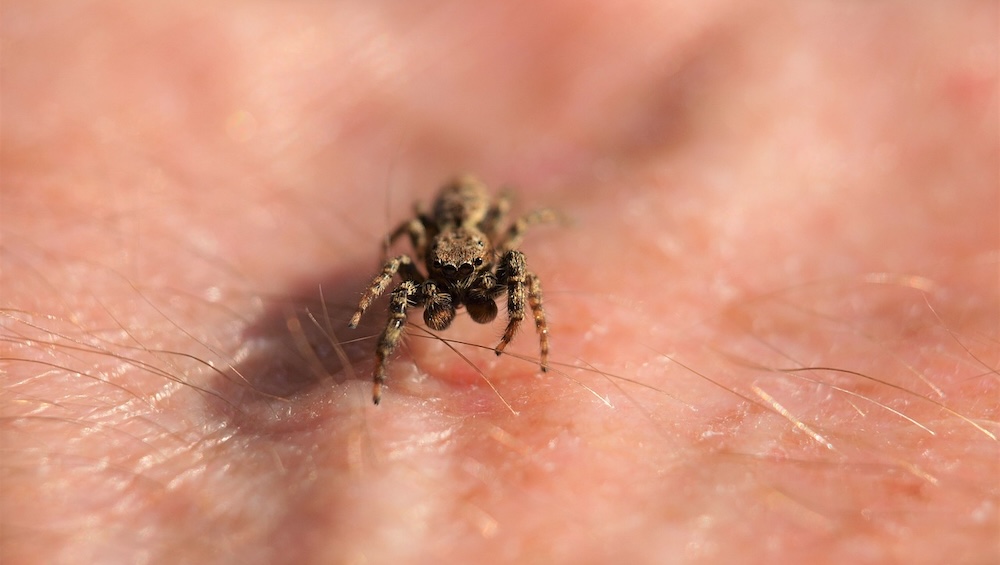 Il Se Rend Aux Urgences En Raison Dune Araign E Vivante Coinc E Dans