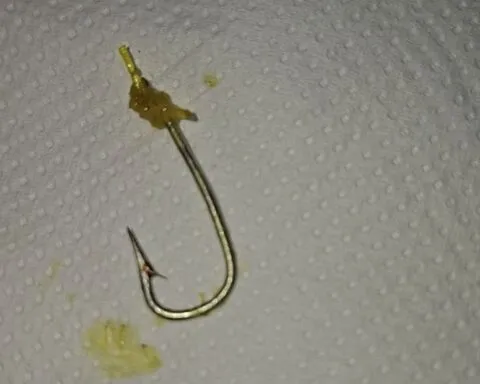 Il découvre un hameçon dans une tête de poisson achetée en grande surface